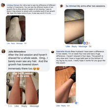 Load image into Gallery viewer, HeySilkySkin Laser Hair Removal Handset
